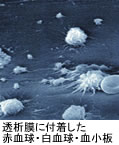 透析膜に付着した赤血球・白血球・血小板