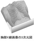 胸部X線画像の3次元図